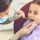 Children with Bruxism-low level laser treatment (LLLT) to acupoints